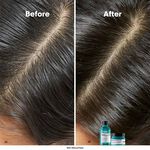 L'Or&eacute;al Professionnel Serie Expert Scalp Advanced Anti-Oiliness Dermo Purifier Shampoo 300ml