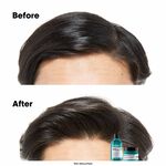 L'Or&eacute;al Professionnel Serie Expert Scalp Advanced Anti-Oiliness 2-in-1 Deep Purifier Clay Mask 250ml
