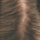 Root Touch-up